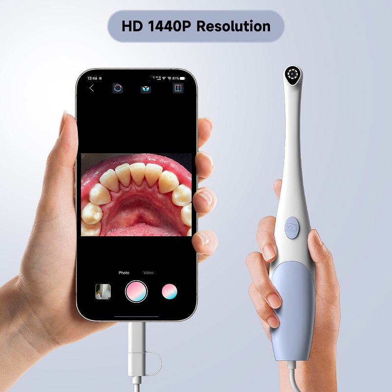 Oral Endoscope Camera 1440P Ph - Macro Photography Led Lighting ulasan dan harga